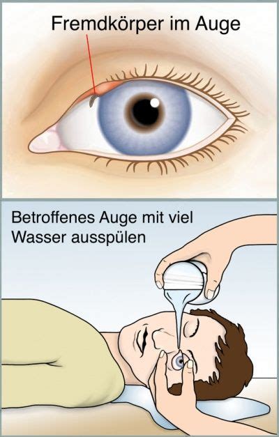 Parfüm im Auge: Was passiert und Erste Hilfe .